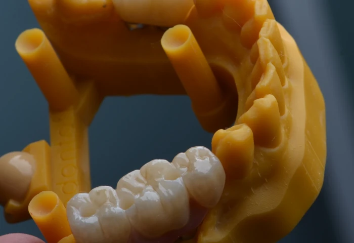 O Uso de Biomodelos Impressos em 3D no Planejamento de Reabilitação de Maxilas Atrófica...