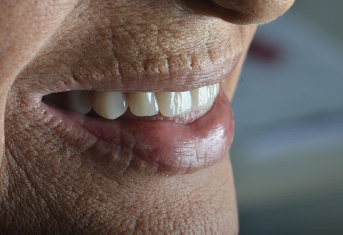 Quando decidi me especializar em implantes zigomáticos?